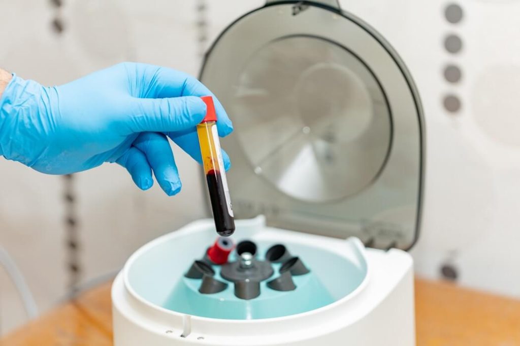 A centrifuge for spinning blood, with one vial of blood, preparing to spin as a part of a Regenerative Medicine treatment